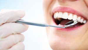 white teeth