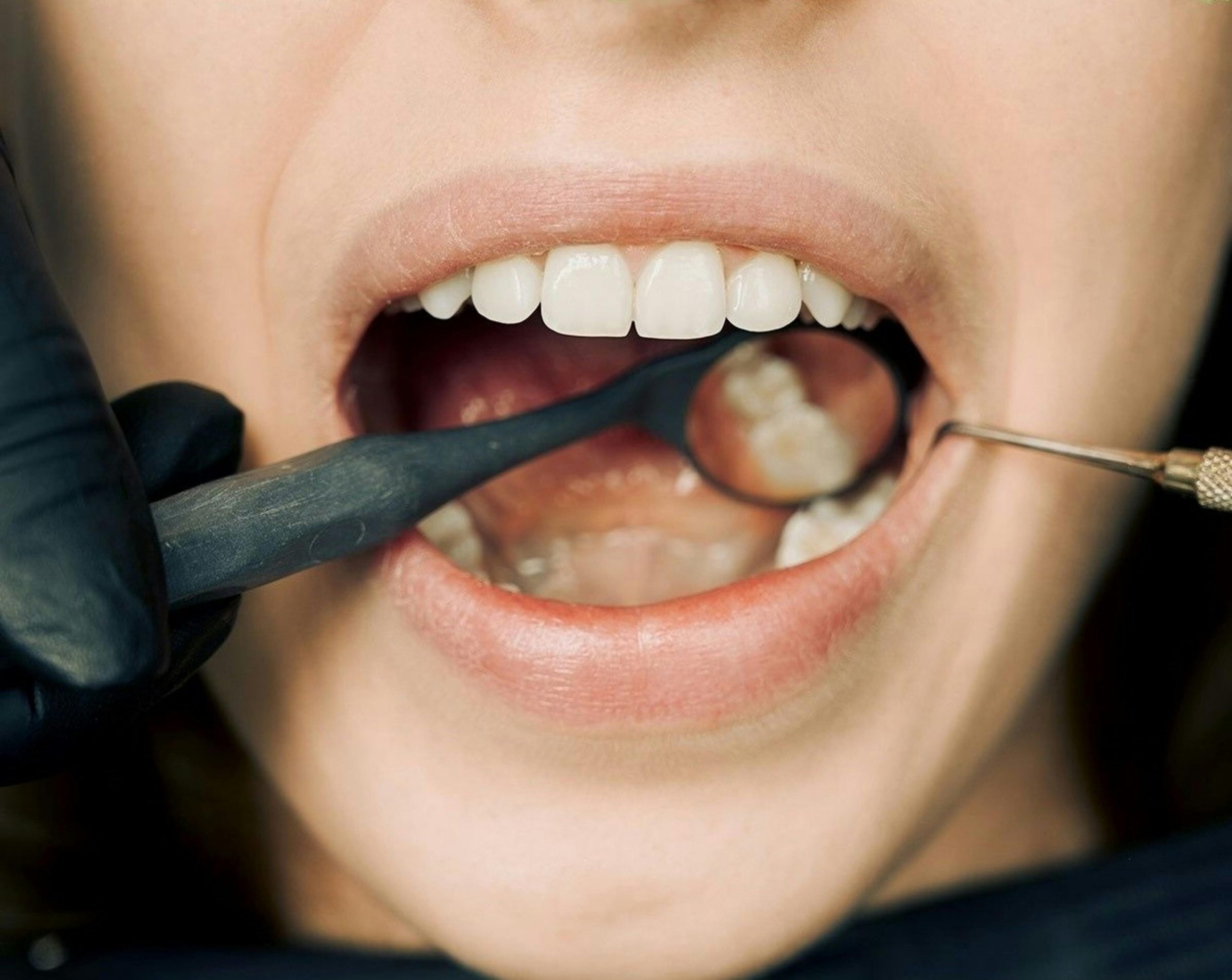 Restorative Dentistry Service